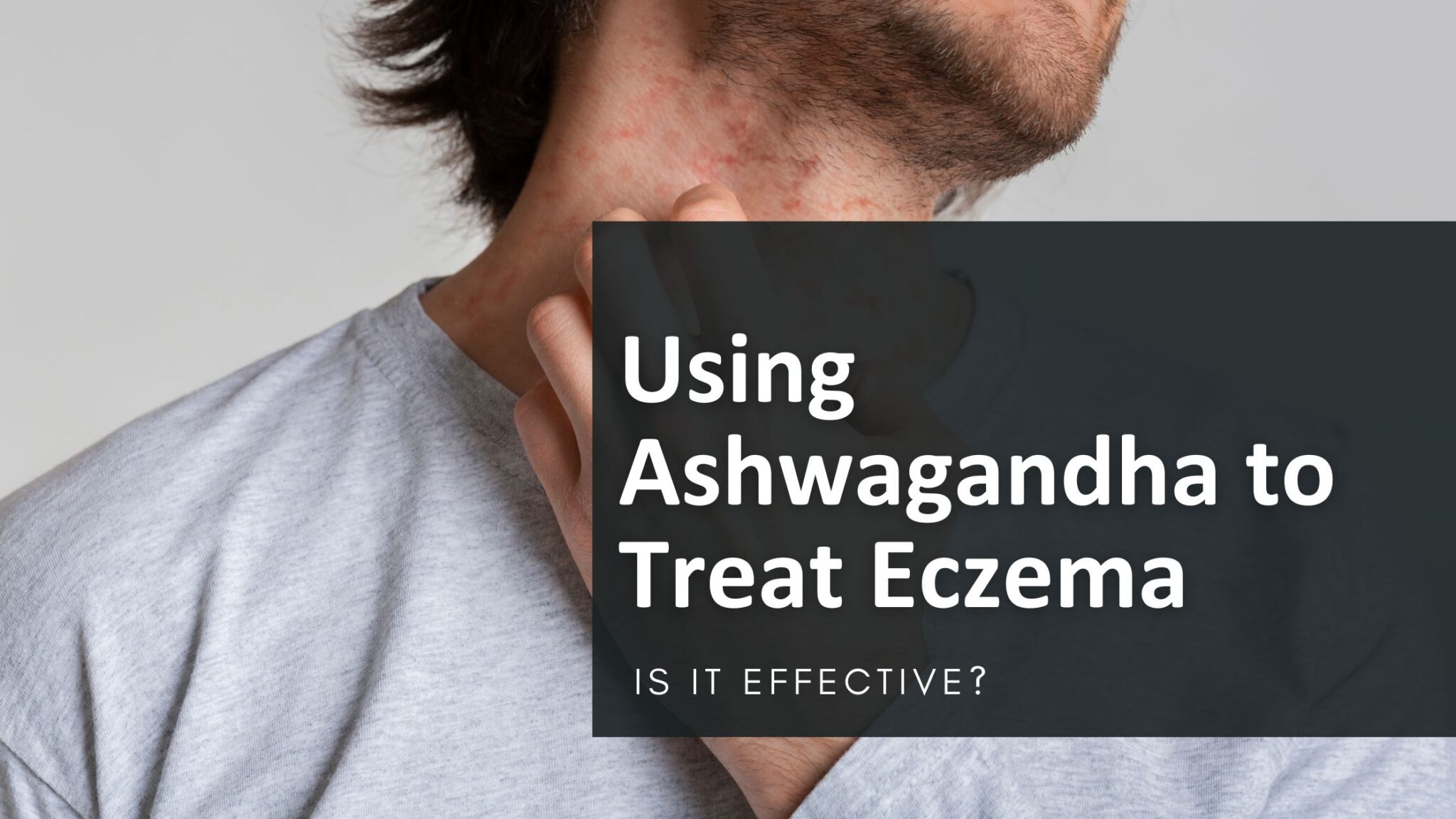Using Ashwagandha to Treat Eczema: The Benefits and How-To Guide